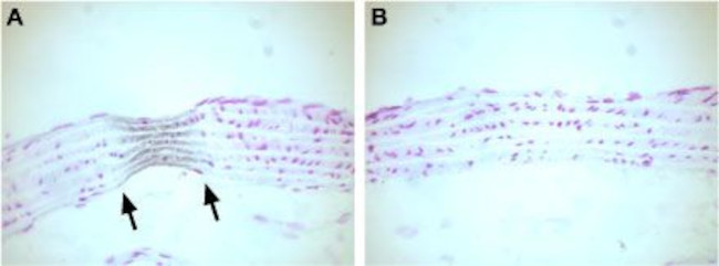CaV1.2a (CACNA1C) Antibody in Immunohistochemistry (IHC)