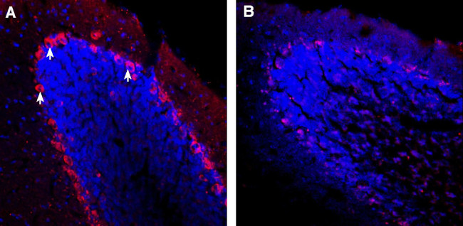 TRPC3 Antibody in Immunohistochemistry (Frozen) (IHC (F))