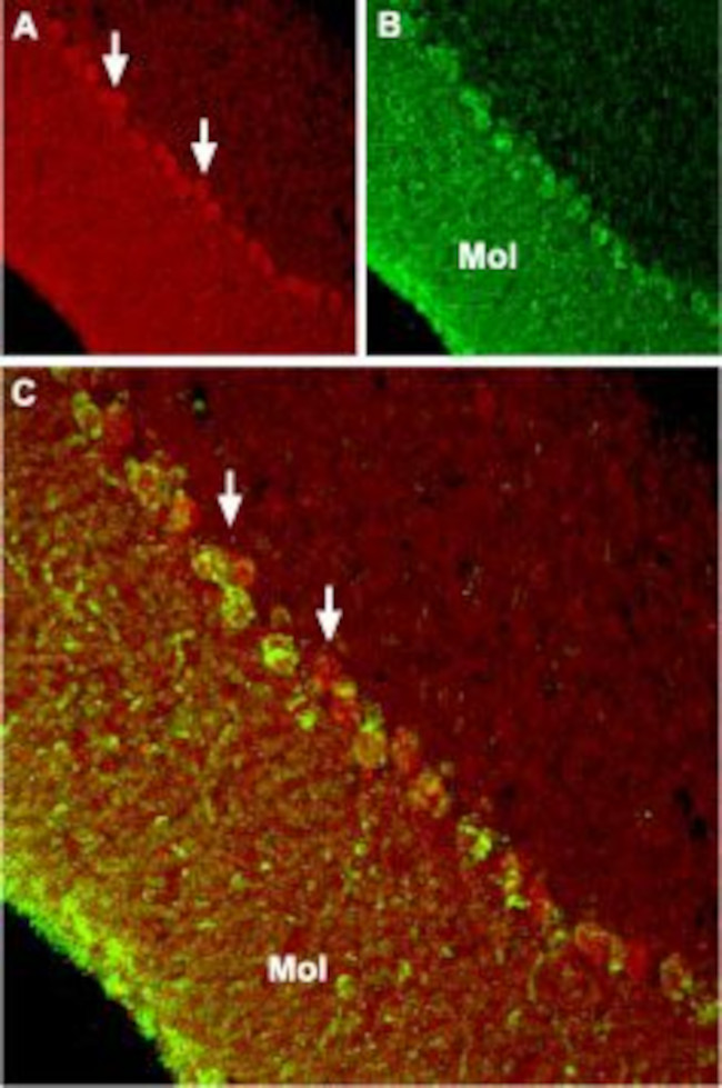 TRPC6 Antibody in Immunohistochemistry (IHC)