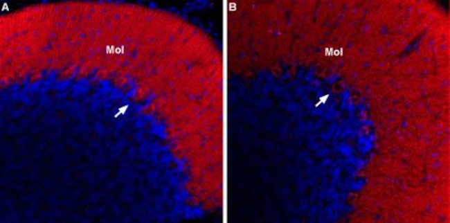 CACNA1G (CaV3.1) Antibody in Immunohistochemistry (IHC)