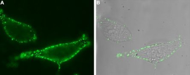 TRPV6 (extracellular) Antibody in Immunocytochemistry (ICC/IF)