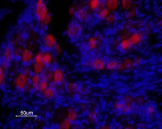 TRPV1 (VR1) (extracellular) Antibody in Immunohistochemistry (Frozen) (IHC (F))