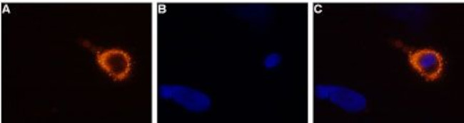 TRPV3 (extracellular) Antibody in Immunocytochemistry (ICC/IF)