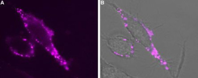 TRPV3 (extracellular) Antibody in Immunocytochemistry (ICC/IF)