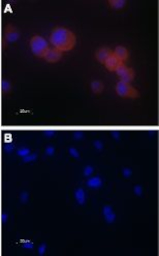 TRPV5 Antibody in Immunocytochemistry (ICC/IF)