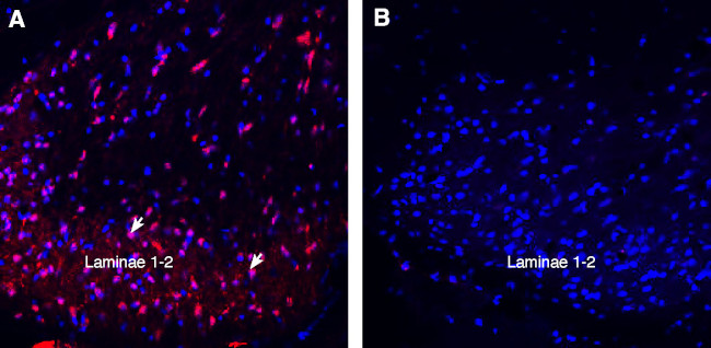 TRPA1 (extracellular) Antibody in Immunohistochemistry (Frozen) (IHC (F))