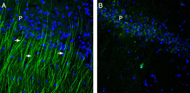 TRPM6 (extracellular) Antibody in Immunohistochemistry (Frozen) (IHC (F))