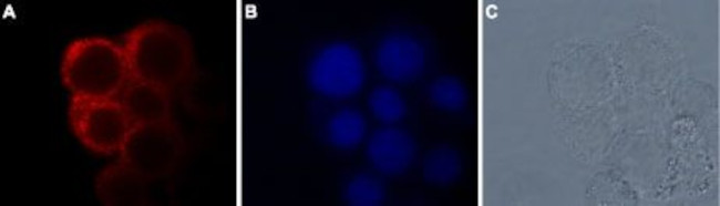 TRPM7 Antibody in Immunocytochemistry (ICC/IF)