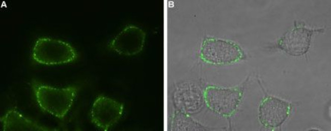 Orai1 (extracellular) Antibody in Immunocytochemistry (ICC/IF)