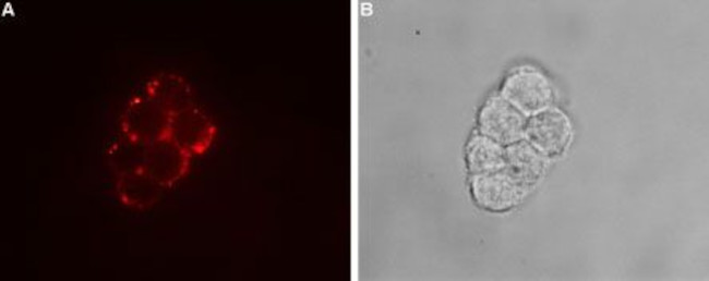TRPC7 (extracellular) Antibody in Immunocytochemistry (ICC/IF)