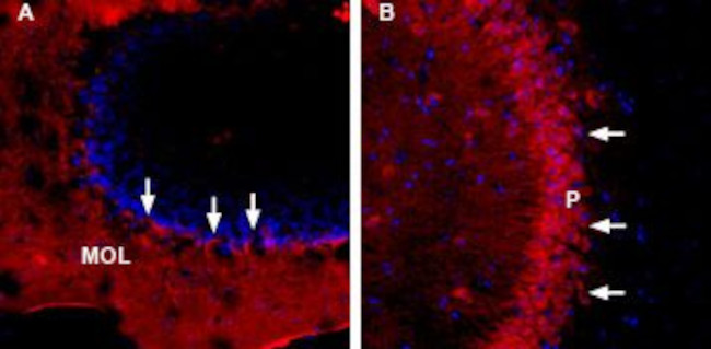 TMEM66 Antibody in Immunohistochemistry (Frozen) (IHC (F))