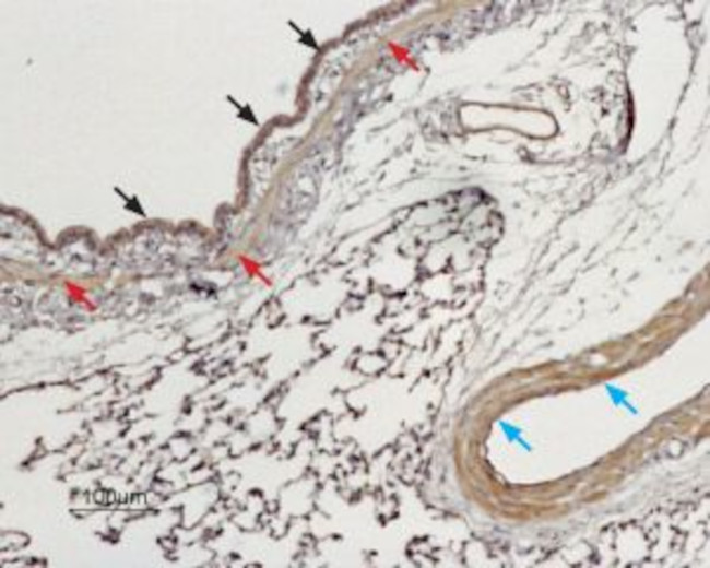 TPCN1 Antibody in Immunohistochemistry (Paraffin) (IHC (P))