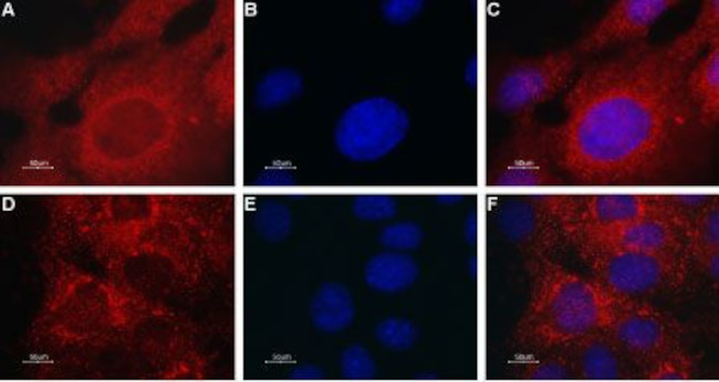 TRPML2 (Mucolipin-2) Antibody in Immunocytochemistry (ICC/IF)