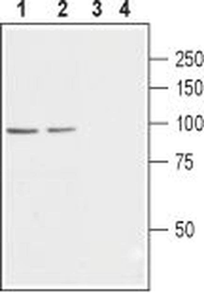 CACNB2 Antibody in Western Blot (WB)
