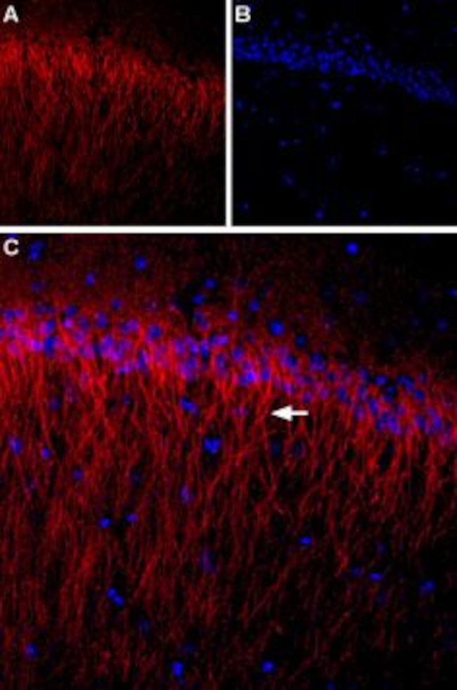CACNB1 Antibody in Immunohistochemistry (IHC)