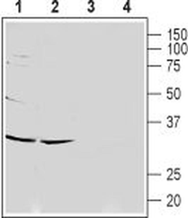 CACNG7 (extracellular) Antibody in Western Blot (WB)