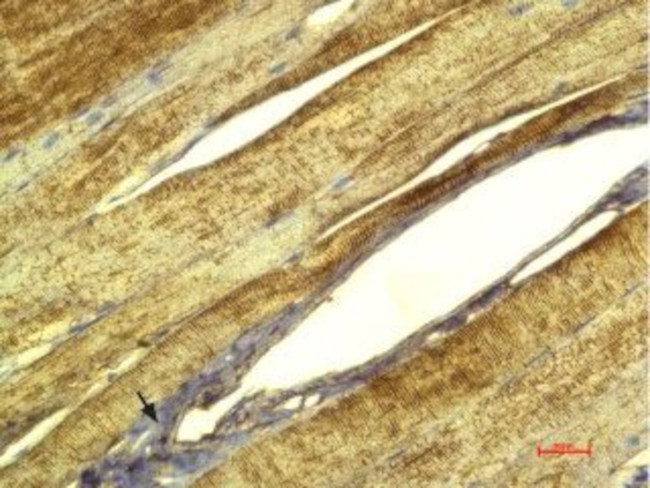 CACNG1 (extracellular) Antibody in Immunohistochemistry (Paraffin) (IHC (P))