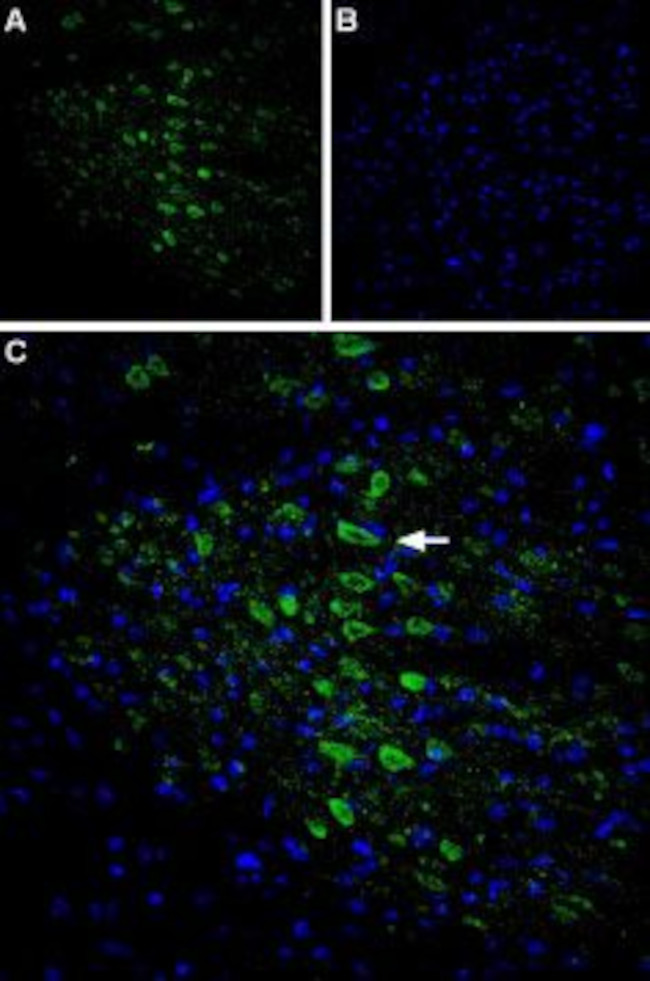 CACNG6 (extracellular) Antibody in Immunohistochemistry (IHC)