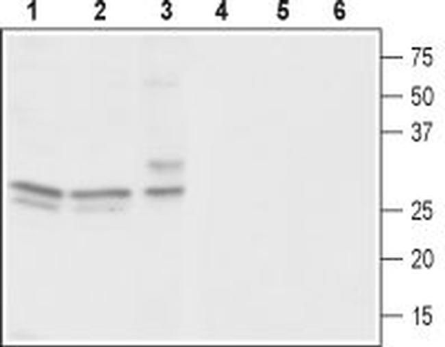 CACNG3 Antibody in Western Blot (WB)