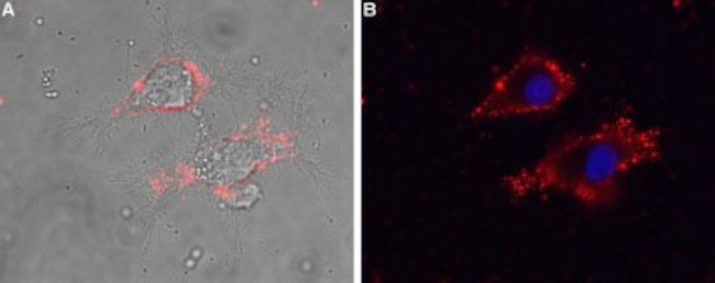 CACNG5 (extracellular) Antibody in Immunocytochemistry (ICC/IF)