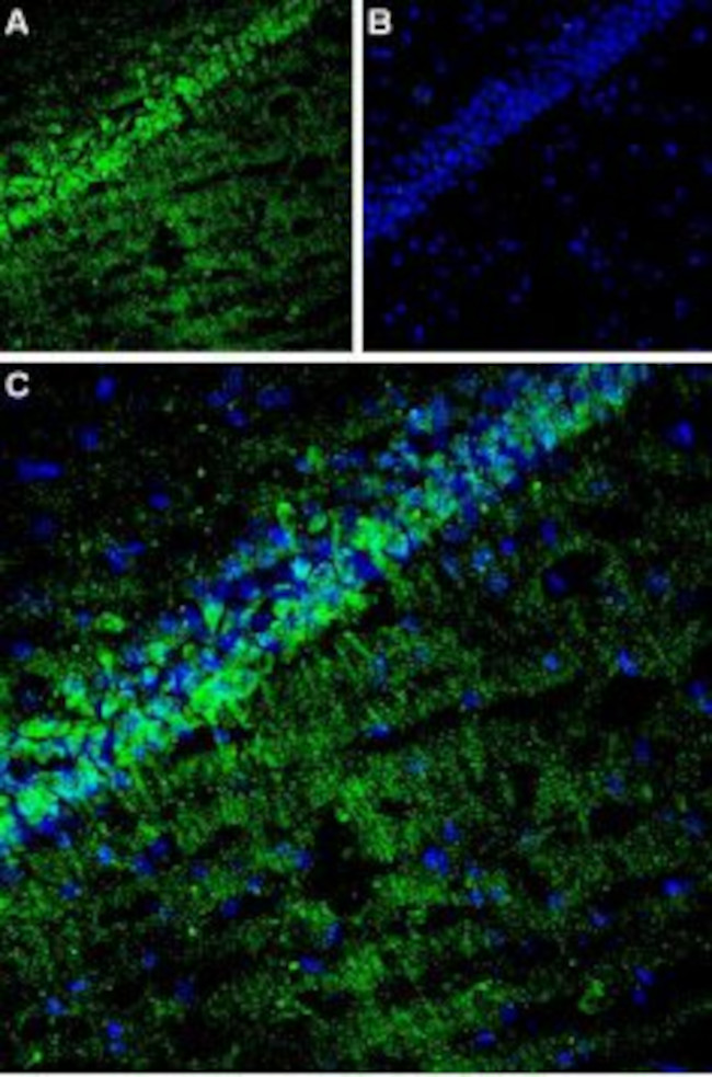 CACNG8 Antibody in Immunohistochemistry (IHC)