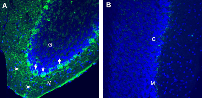 CaV1.2 (CACNA1C) (extracellular) Antibody in Immunohistochemistry (Frozen) (IHC (F))