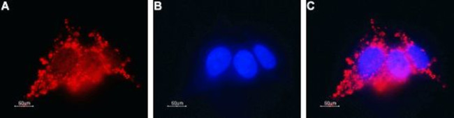 Connexin-26 (GJB2) Antibody in Immunocytochemistry (ICC/IF)