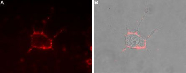 CaV1.3 (CACNA1D) (extracellular) Antibody in Immunocytochemistry (ICC/IF)