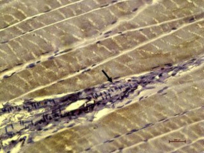 CaV1.1 (CACNA1S) (extracellular) Antibody in Immunohistochemistry (Paraffin) (IHC (P))