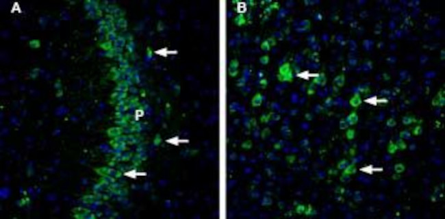 CHERP Antibody in Immunohistochemistry (IHC)
