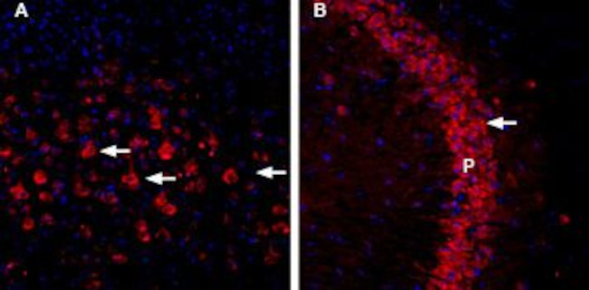 CHERP Antibody in Immunohistochemistry (IHC)