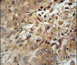 ACAD10 Antibody in Immunohistochemistry (IHC)