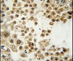 ACE2 Antibody in Immunohistochemistry (IHC)