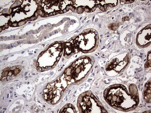 ACE2 Antibody in Immunohistochemistry (Paraffin) (IHC (P))