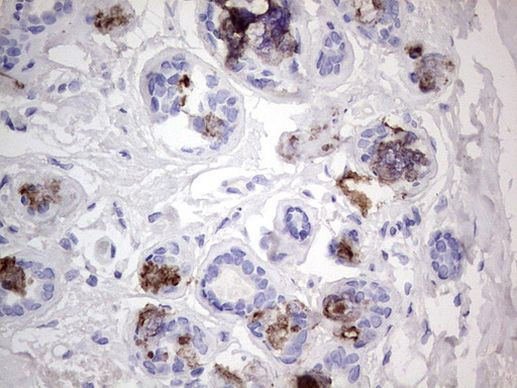 ACE2 Antibody in Immunohistochemistry (Paraffin) (IHC (P))