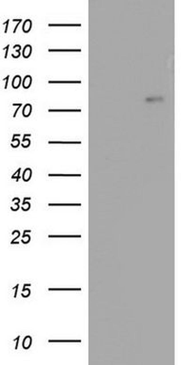 ACE2 Antibody in Western Blot (WB)
