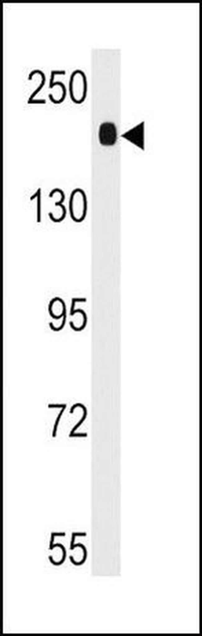 ACE Antibody in Western Blot (WB)