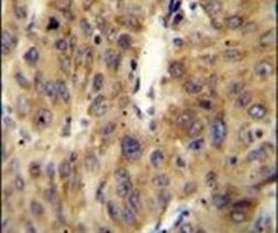 A1CF Antibody in Immunohistochemistry (IHC)