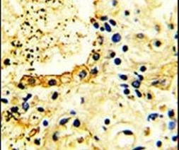 ACK1 Antibody in Immunohistochemistry (IHC)