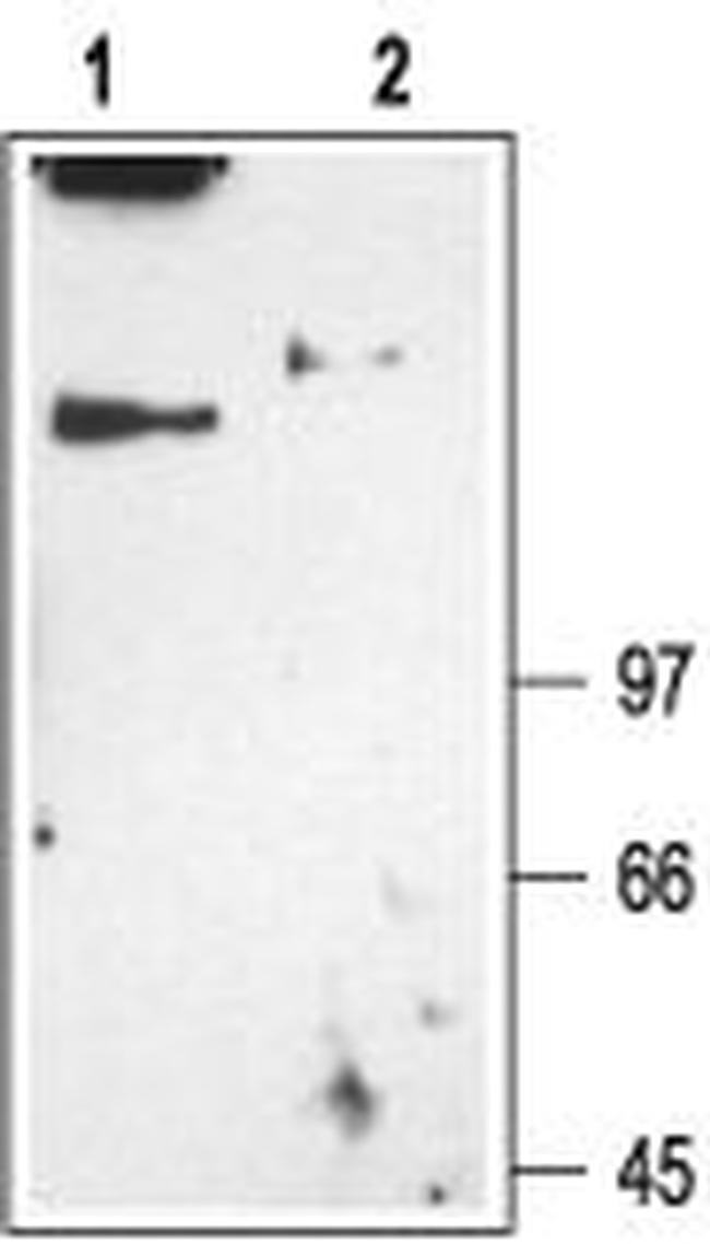 CLC-1 (CLCN1) Antibody in Western Blot (WB)