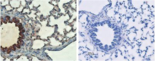 CFTR Antibody in Immunohistochemistry (IHC)