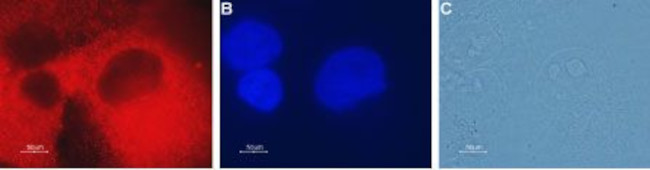 CLIC4 Antibody in Immunocytochemistry (ICC/IF)