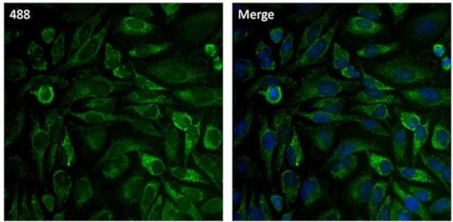 Aconitase 2 Antibody in Immunocytochemistry (ICC/IF)