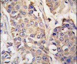 Aconitase 2 Antibody in Immunohistochemistry (IHC)