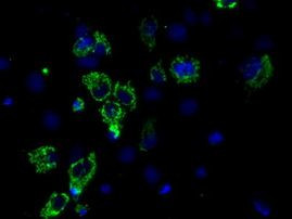 ACO2 Antibody in Immunocytochemistry (ICC/IF)