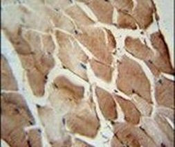 ACOT11 Antibody in Immunohistochemistry (IHC)