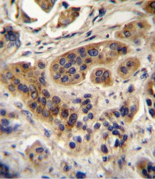ACOX1 Antibody in Immunohistochemistry (IHC)