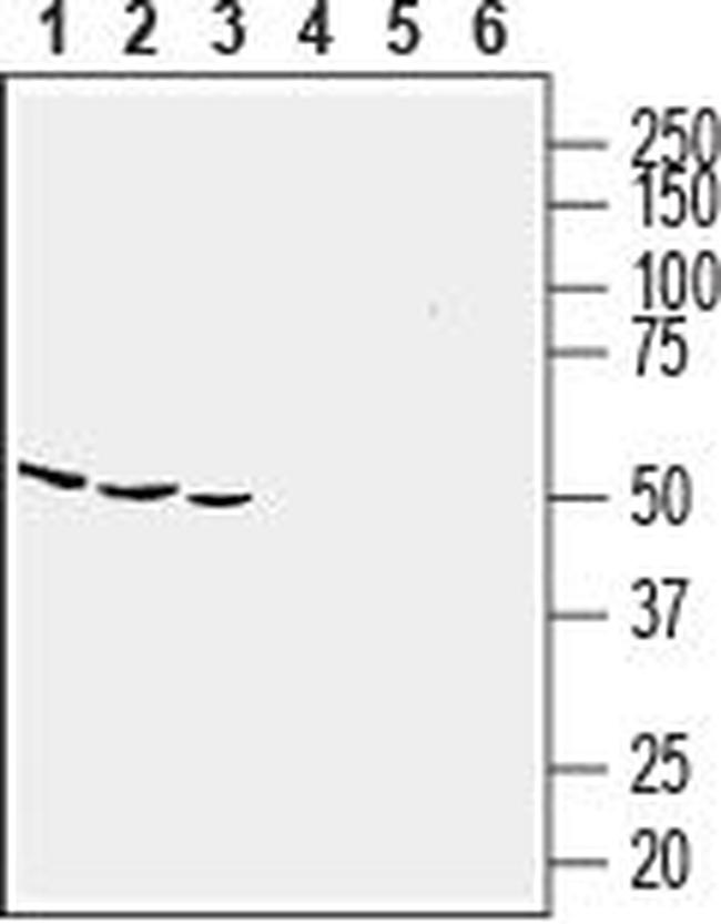 CCR5 (extracellular) Antibody in Western Blot (WB)