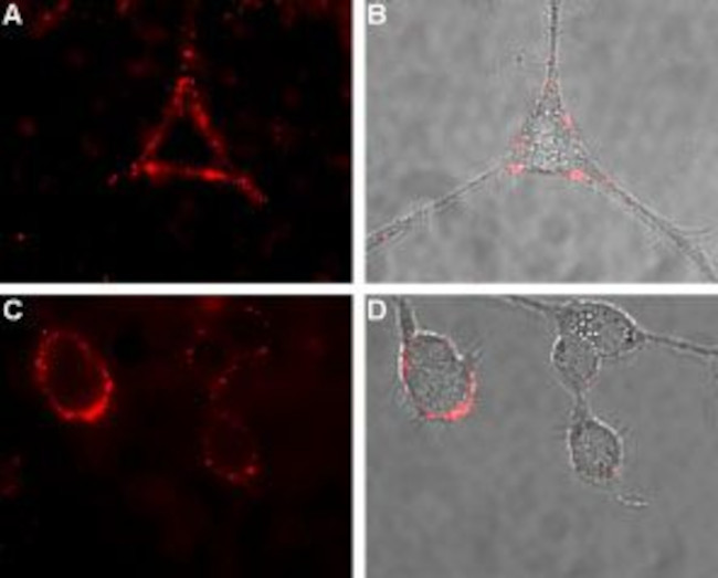 Calcitonin Receptor (extracellular) Antibody in Immunocytochemistry (ICC/IF)