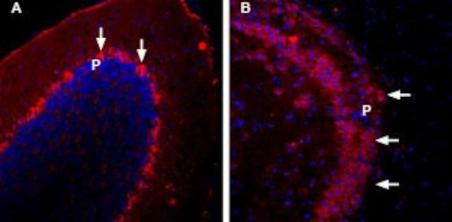 NCS1 Antibody in Immunohistochemistry (IHC)